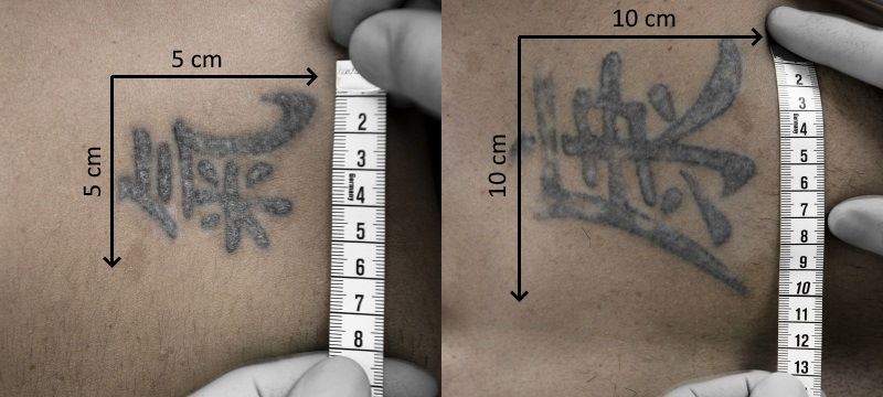 Grösse des Tattoos für die Tattooentfernung in Schaffhausen ausmessen – Länge und Breite in Zentimetern